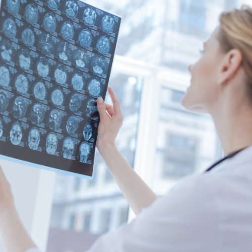 PG Diploma in Neurology (Courses for Doctors) (Courses after MBBS/MD/MS/DNB)